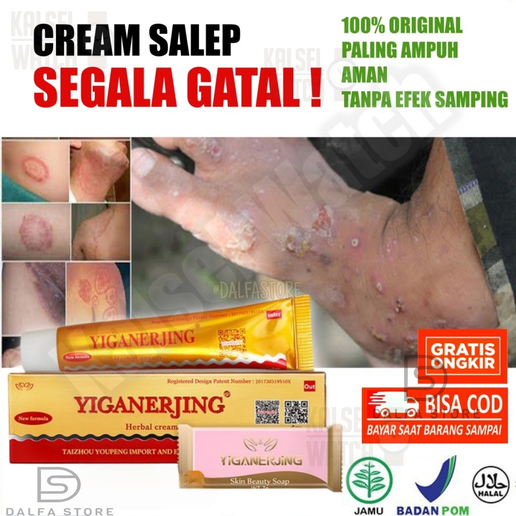 Obat Herbal Cream Salep Sabun SEGALA GATAL Yiganerjing ORIGINAL 100% AMPUH AMAN Dermatitis Eksim OC5