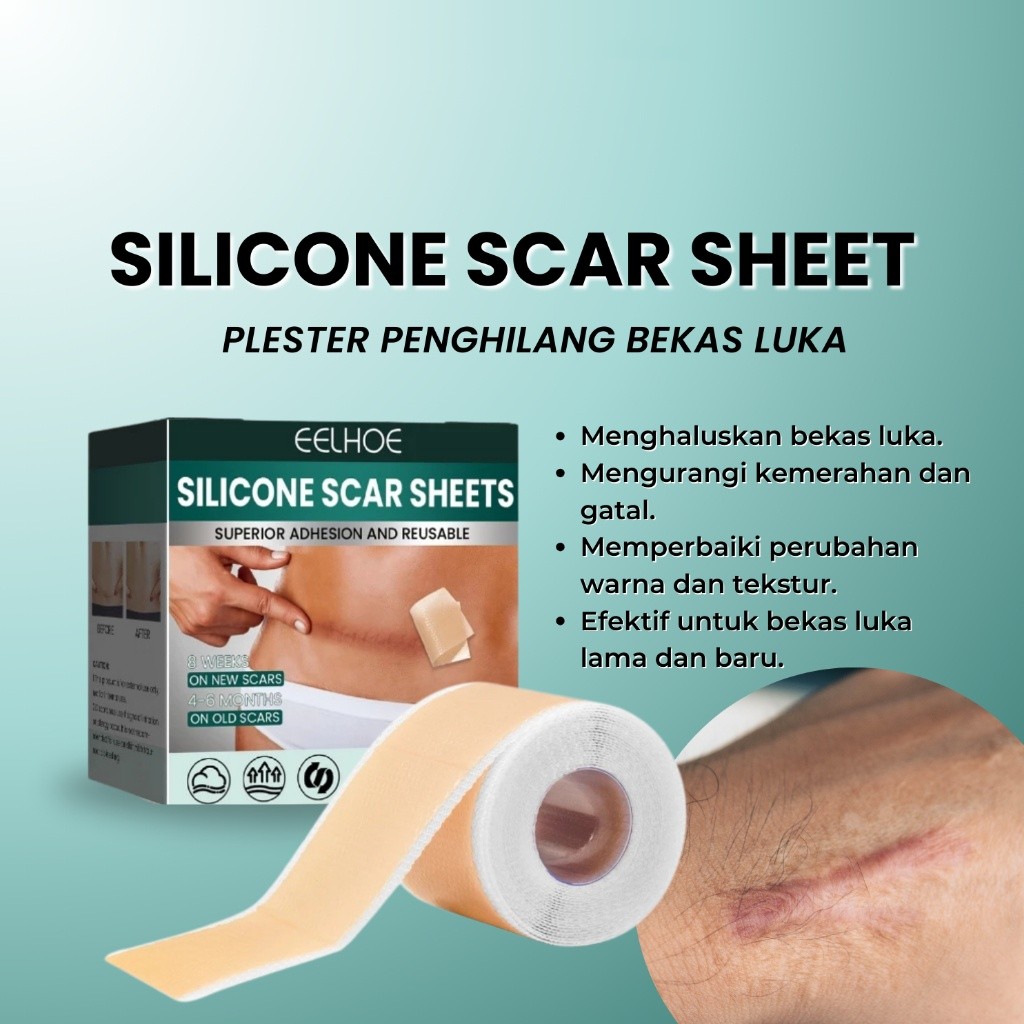 T8 EELHOE Dermaline Silicone Keloid 1Roll Keloplast Silicone Keloid Plester Scar Tape Keloid Bekas L