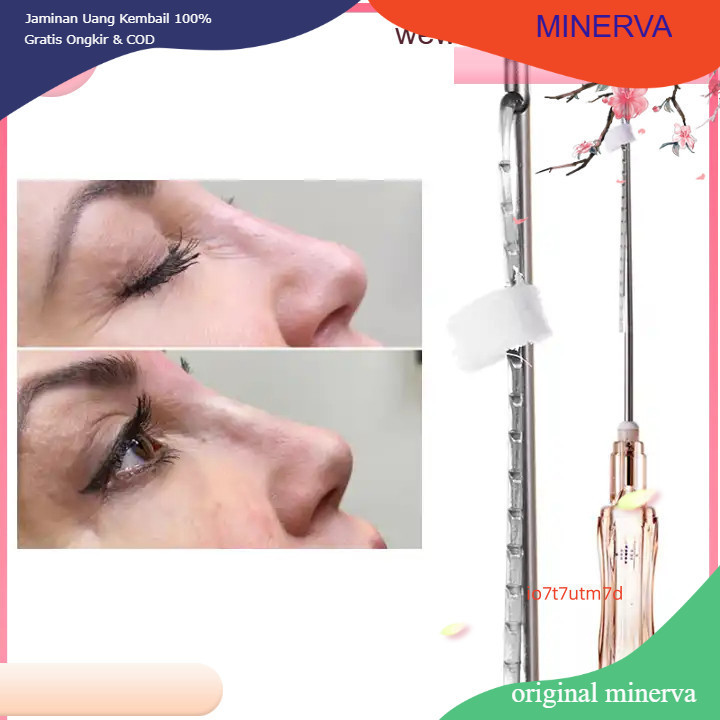 made in korea isi 2pc benang Minerva benang hidung  PCL&PDO  19g*60mm&19g*38mm/a pack  of 2benang