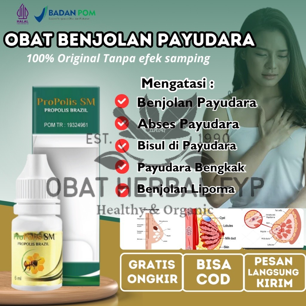 Penghancur Benjolan Tumor Payudara, Pengempis Benjolan Payudara Tumor Payudara, Obat Benjolan Lipoma