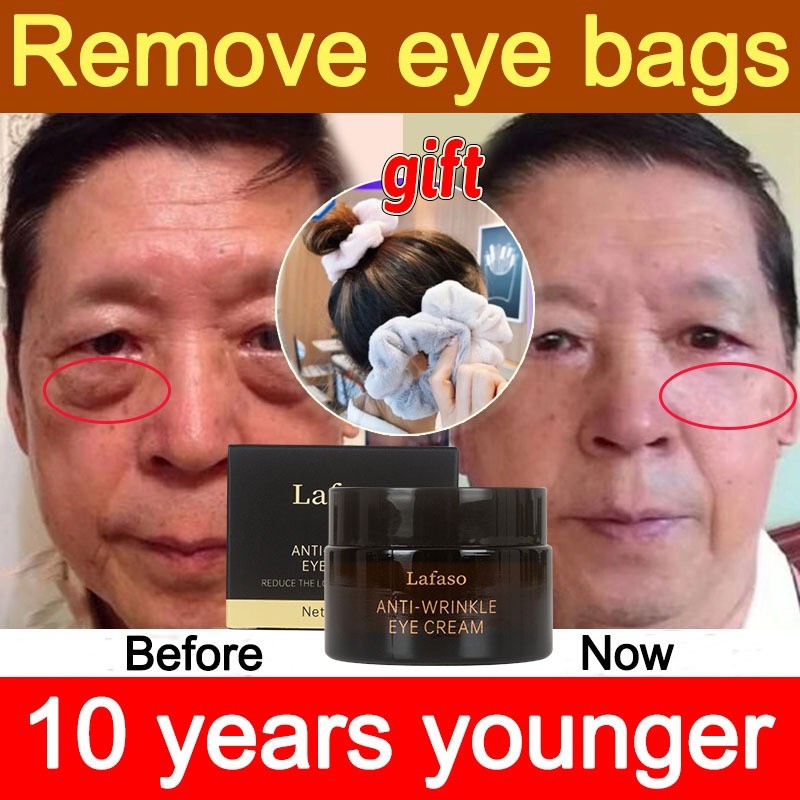 [BPOM] LAFASO Cream Mata - Krim Mata Atasi Kerutan, Garis Halus, Kantung Mata, Dan Mata Panda - Penc