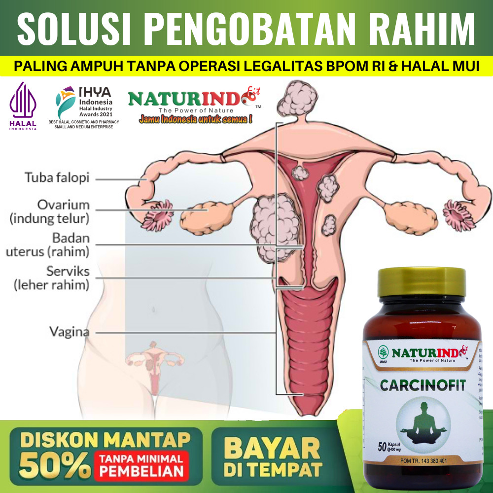 Obat Tumor Rahim Paling Ampuh, Kanker Serviks, Tumor Jinak di Rahim, Obat Tumor Rahim Tanpa Operasi,