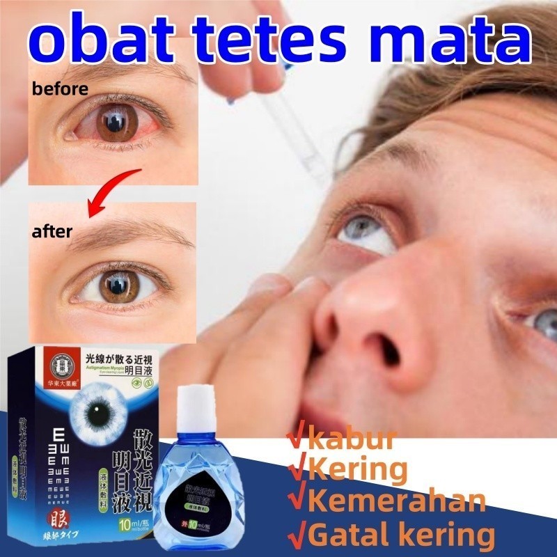 obat mata obat tetes mata obat mata katarak obat mata minus tetes mata minus 10ml Mata Kering Sakit