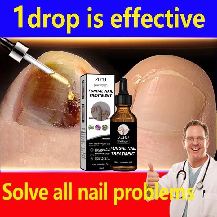 TS_ Obat Jamur Kuku Obat Kuku Jamur Dan Rusak Perawatan Onikomikosis Paronychia Anti Infeksi Kuku To