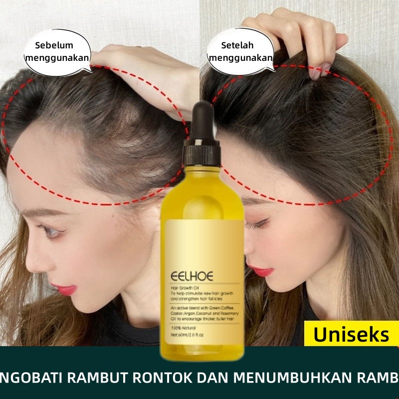 Rosemary Oil Rambut Penumbuh Rambut Botak Perawatan Rambut Rontok Penumbuh Rambut Cepat Hair Growth 