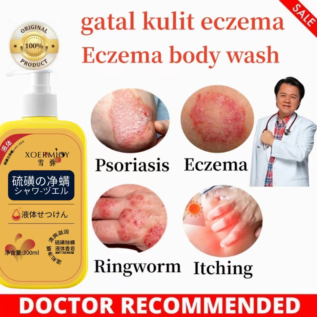 eczema body wash Pengobatan Eksim psoriasis eksim kering Kurap gatal kulit jamur kulit eksim lotion 