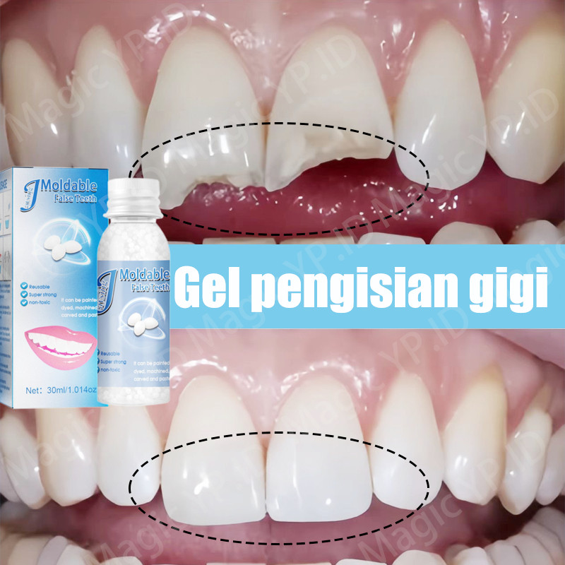 tambal gigi lem gigi palsu permanen tambal gigi permanen penambal gigi berlubang tahan panas penamba