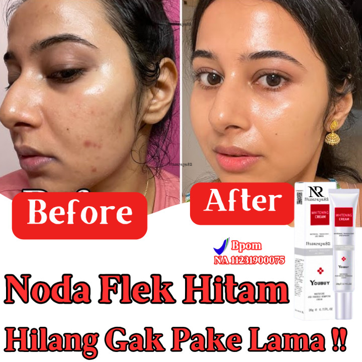 YOUBUY KRIM Whitening PEMUTIH Removing Cream  Whitening Serum  Light spots Brighten skin  20g