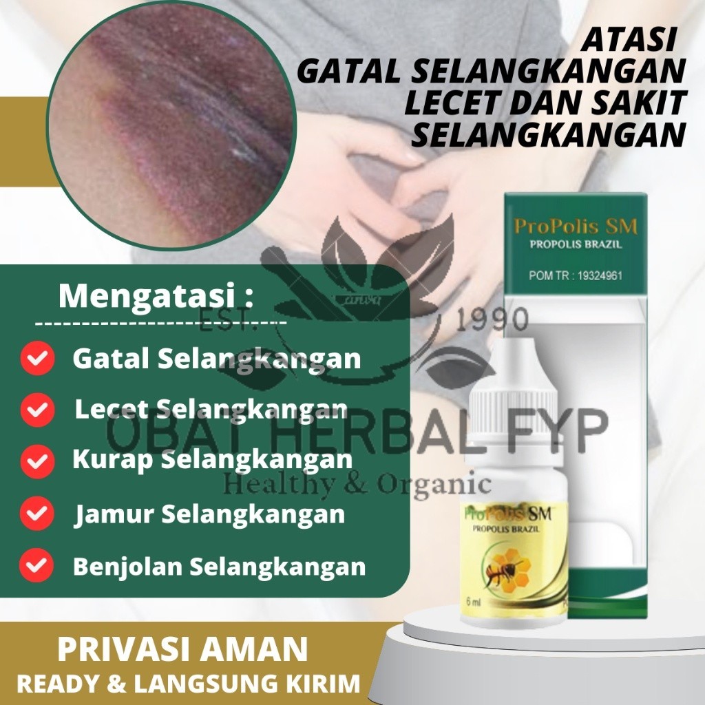Obat Selangkangan Hitam Babak Gatal Berair Gatal Bernanah Gatal Psoriasis Eksim Jamur Kurap Alergi K