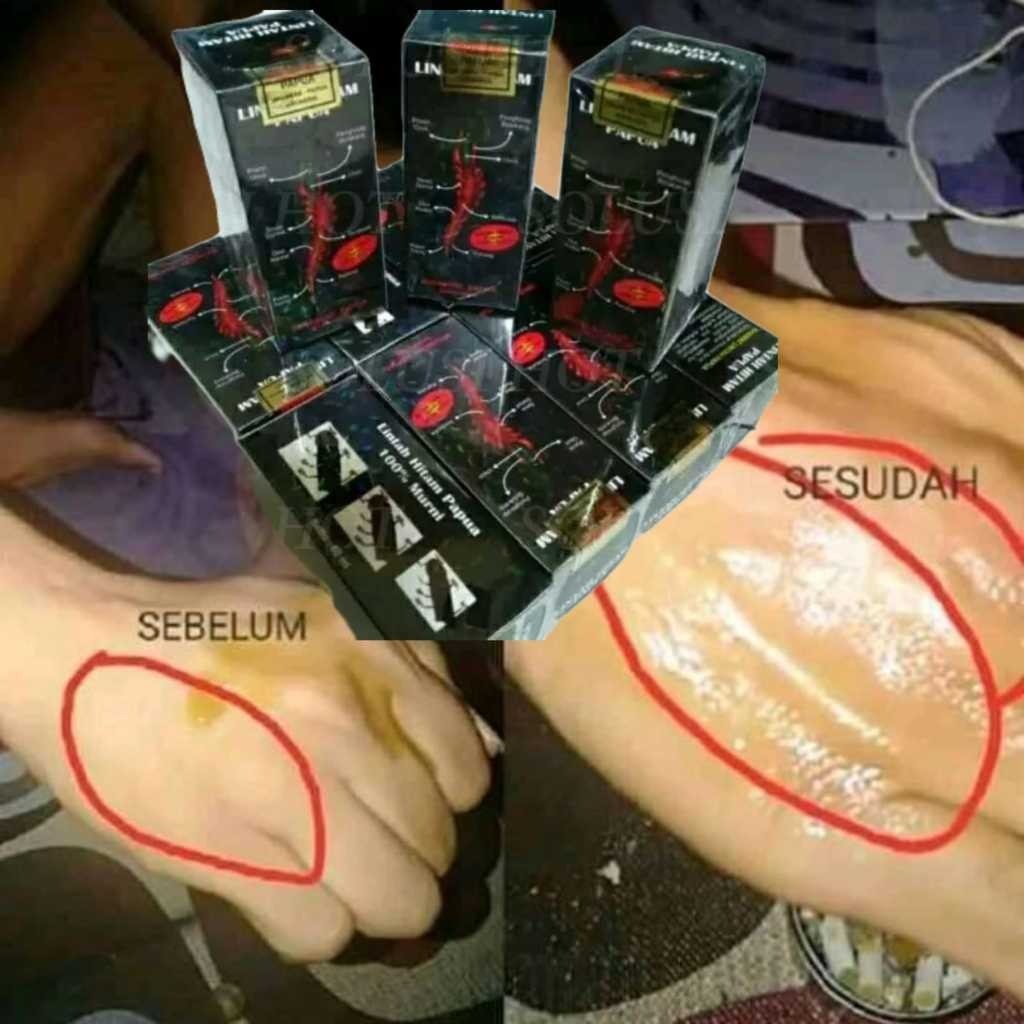 Minyak Lintah Hitam Papua Asli 100% Minyak Lintah Original 100% asli Minyak Lintah Herbal Natural
