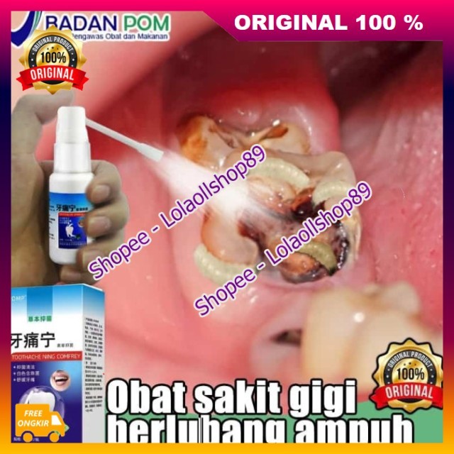 Spray Pereda Sakit Gigi Toothache Obat Sakit Gigi Berlubang Obat Sakit Gigi Semprot Ampuh 100% ASLI 