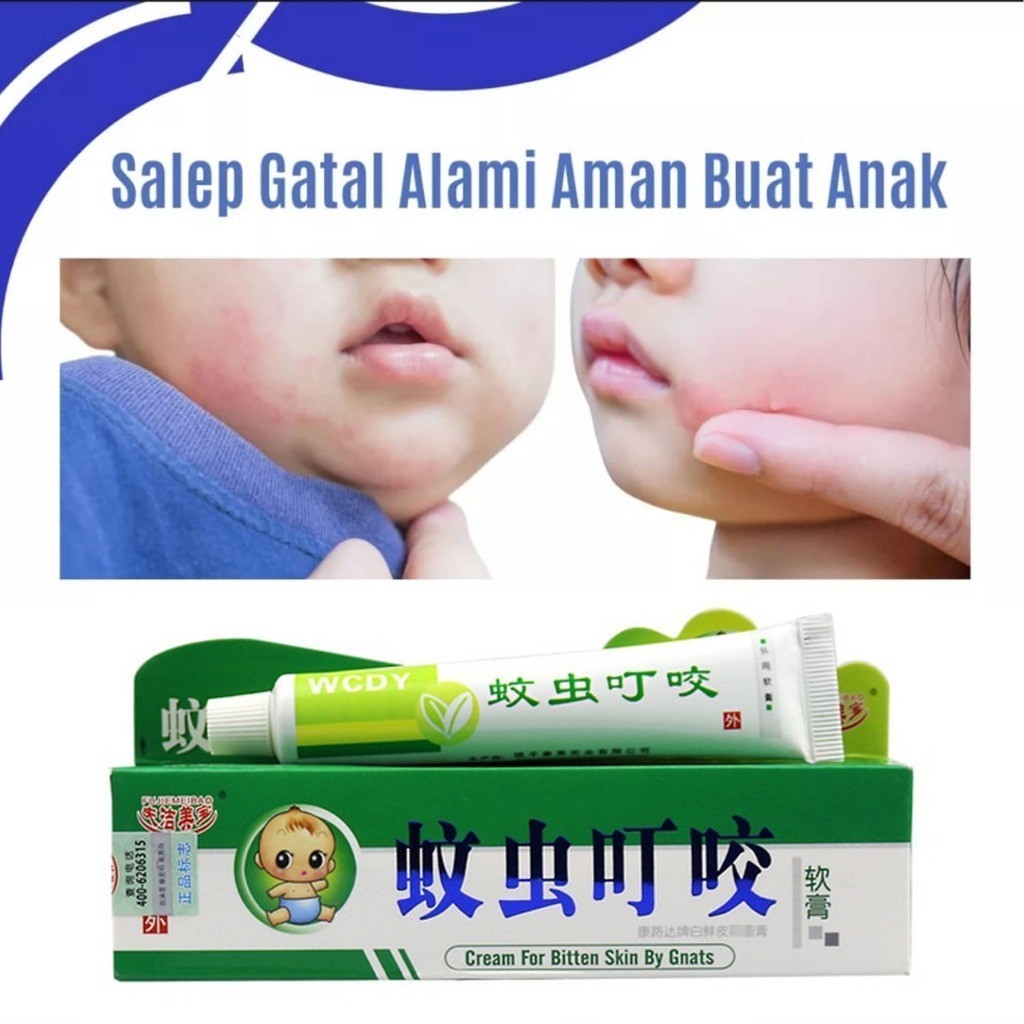 [TERMURAH] Salep Zudaifu Untuk Bayi & Anak Krim Salep Gatal Psoriasis Dermatitis Eksim Original 100%