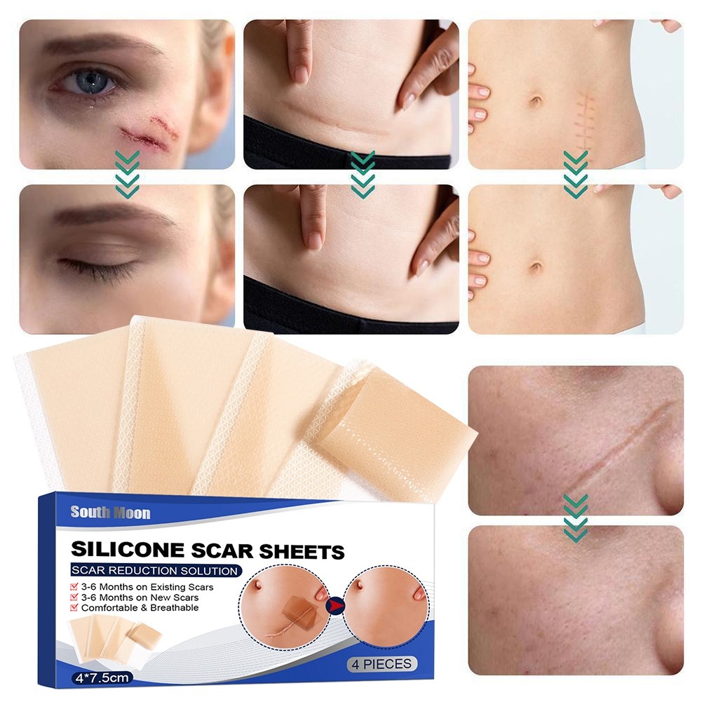 Silicone Scar Sheet plester silikon penghilang keloid bekas luka Silicon Keloid Plester Bekas Luka