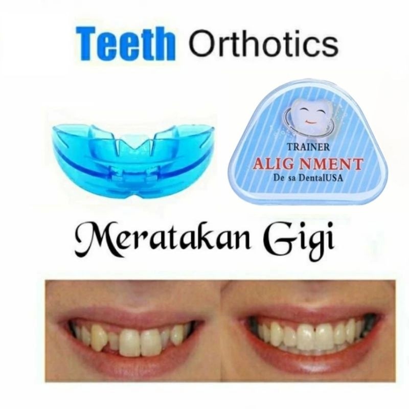 Behel Gigi Praktis Original | Alat Perapi Gigi Gingsul Tonggos