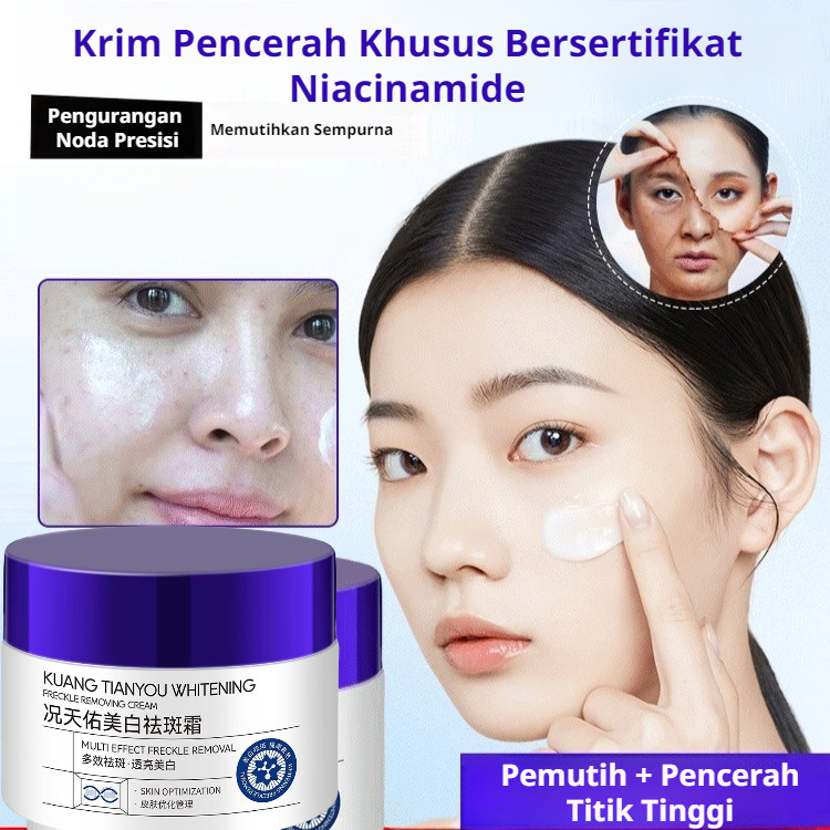 【Pengiriman 24 jam】Dark Spot Whitening Cream/ Krim Penghilang Flek Hitam/Serum Penghilang Noda Super