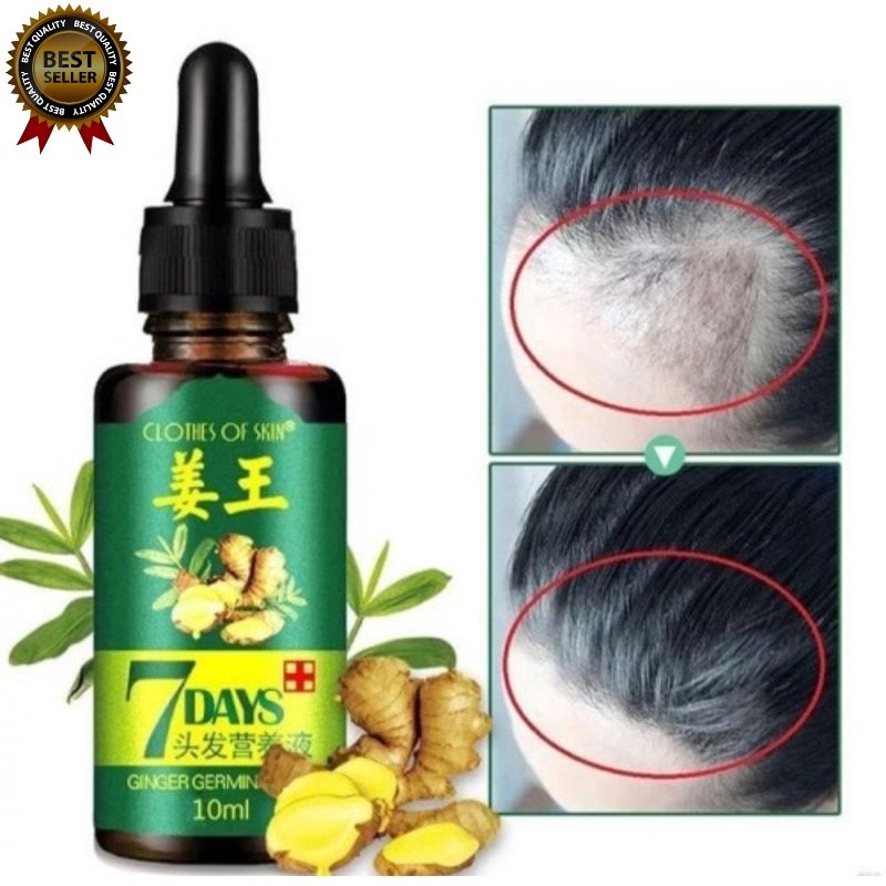 PENUMBUH RAMBUT BOTAK DAN RONTOK PRIA ANAK BAYI CEPAT SERUM ESSENCE Penghitam Uban Penyubur Original