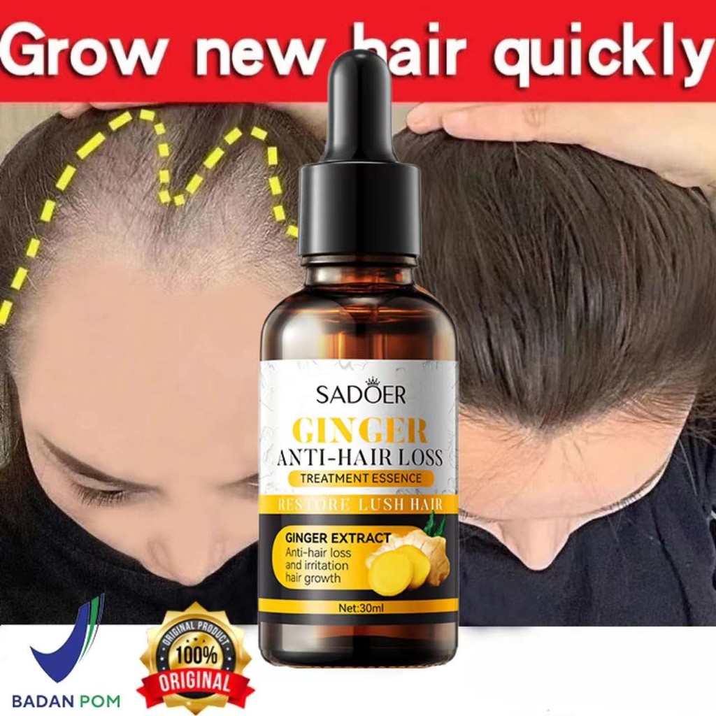 Pertumbuhan rambut penumbuh rambut cepat Ginger King Serum Anti Botak obat penumbuh rambut Penumbuh 