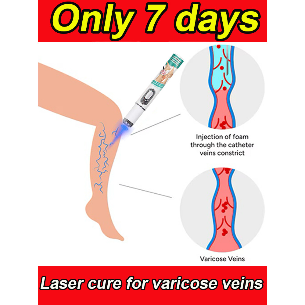 GENERATION-2 LASER VANISH Varicose/Spider Veins