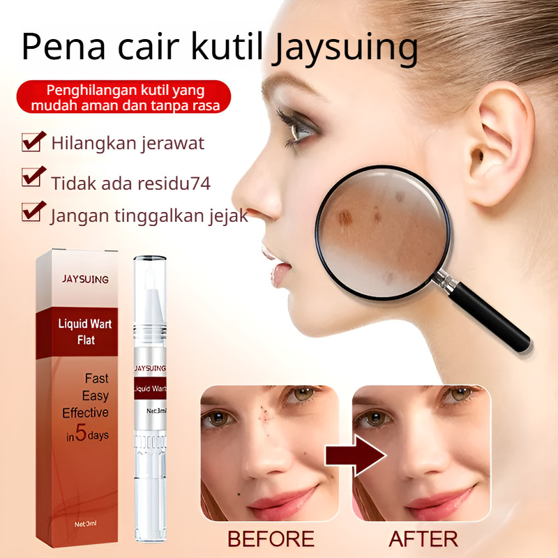 Pensil Obat Kutil untuk Memudarkan Mole dan Kaki Ayam / Pensil Obat Kutil untuk Label Kulit / Perawa