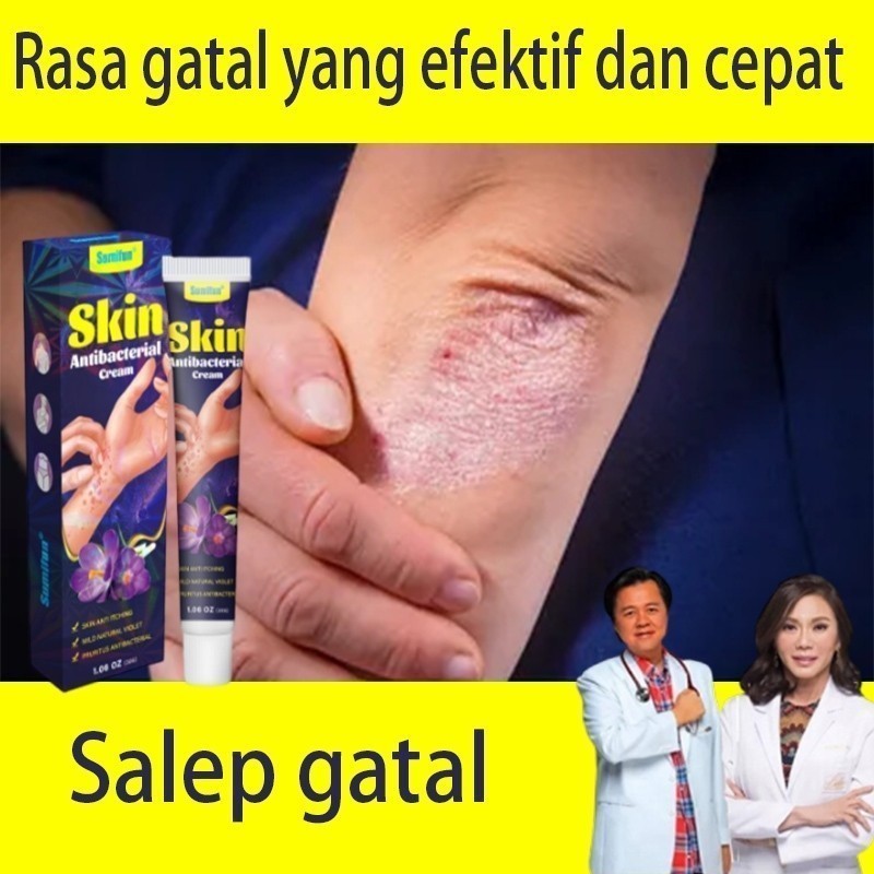 Salep Anti Gatal Psoriasis Salep Anti Gatal Kutil Salep 20G Obat Alergi Gatal Pinggul Tinea capitis 