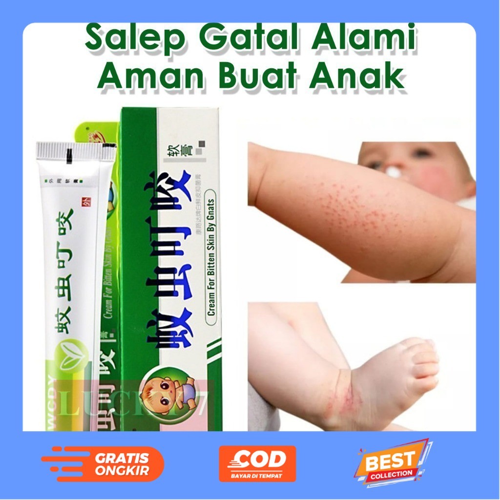 Salep Gatal Paling Ampuh Untuk Anak Bayi Digigit Nyamuk Serangga Kudis
