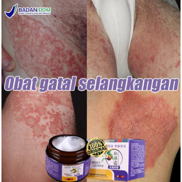 salep gatal paling ampuh salep gatal obat gatal selangkangan obat selangkangan gatal dan hitam obat 