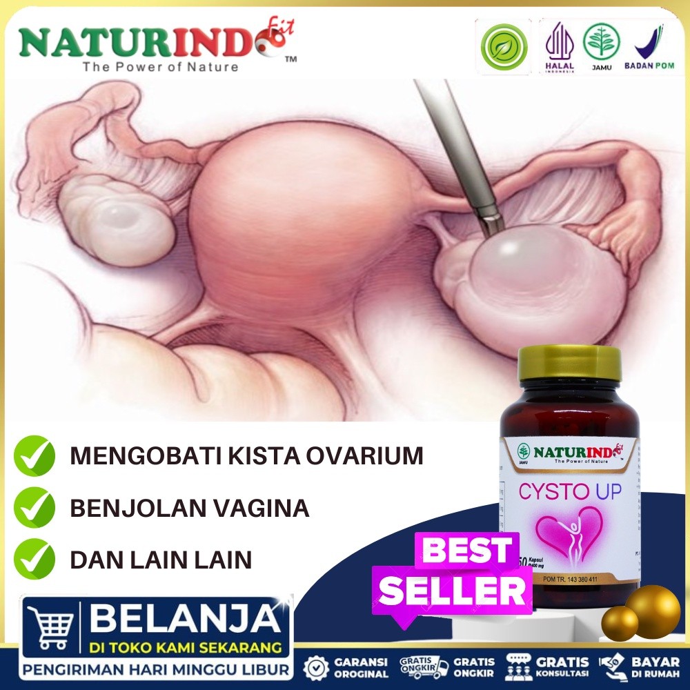 CYSTO UP Obat Kista Ovarium Tanpa Operasi Kanker Serviks Miom Penghancur Kista Dan Miom Paling Ampuh