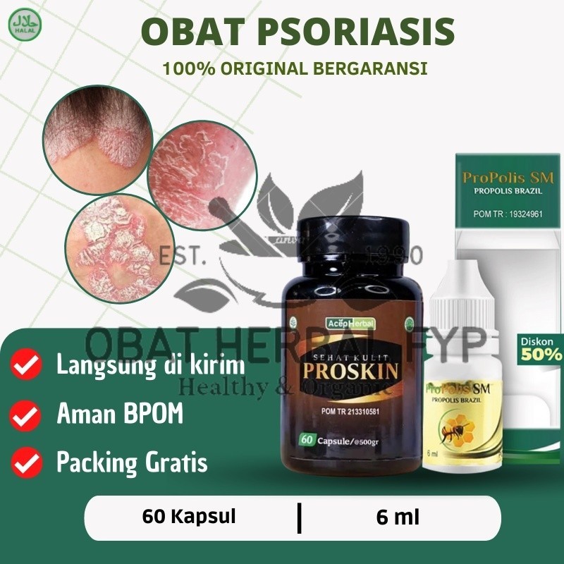 Proskin - Obat Psoriasis, Salep Psoriasis, Obat Psoriasis Kulit Kepala, Obat Kulit Gatal bersisik, O