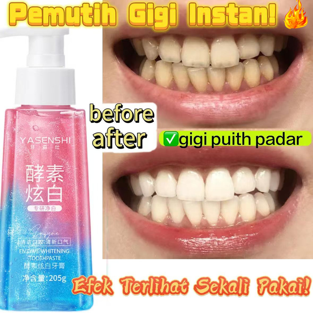 [100% Asli ]Pasta Gigi Pemutih dan Perontok Karang Gigi-Menghilangkan bau mulut Menyegarkan mulut Ce