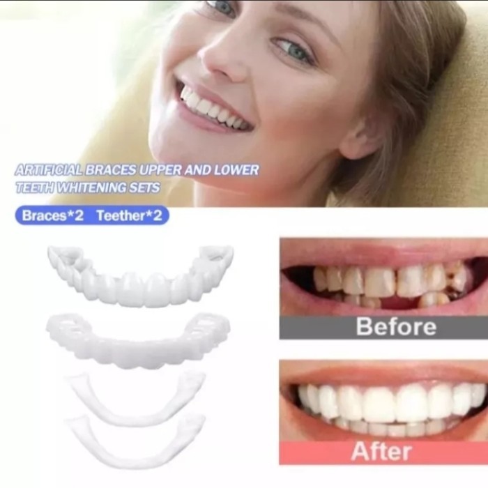 bisa COD Snap on smile veneers original instan
