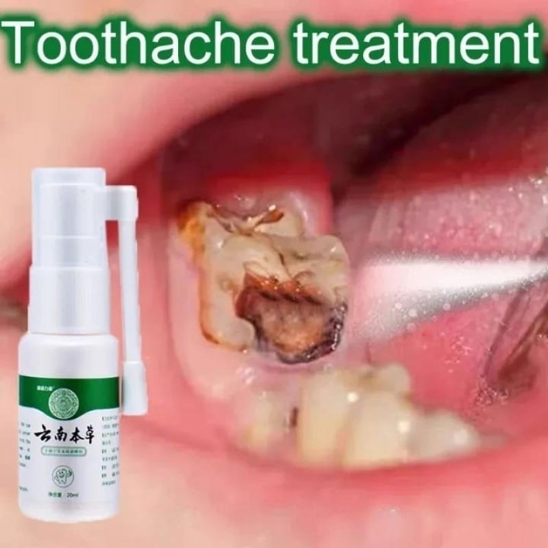 Semprotan Pereda Nyeri Sakit Gigi Perawatan Mulut Pencegahan Gigi Perawatan Pereda Sakit Gigi Sempro