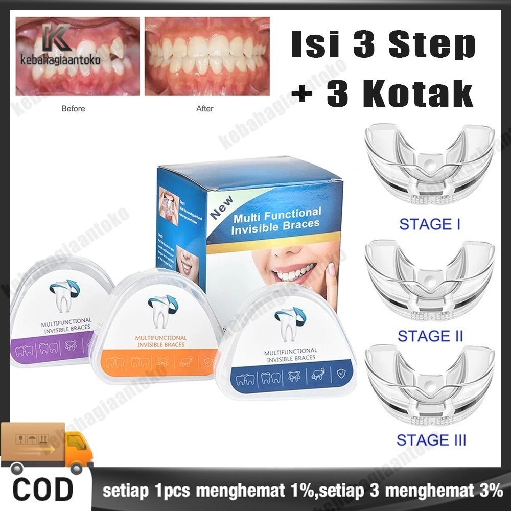 promo Perapi Gigi - Teeth Trainer Allignment - Orthodentic Retainer - Behel Kawat Gigi Transparan - 