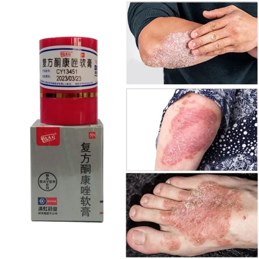 [TERMURAH] JAMIN 100% ASLI  Salep Gatal Kulit Kl Bl Salep Eksim Gatal Selangkangan Jamuran Jerawat K