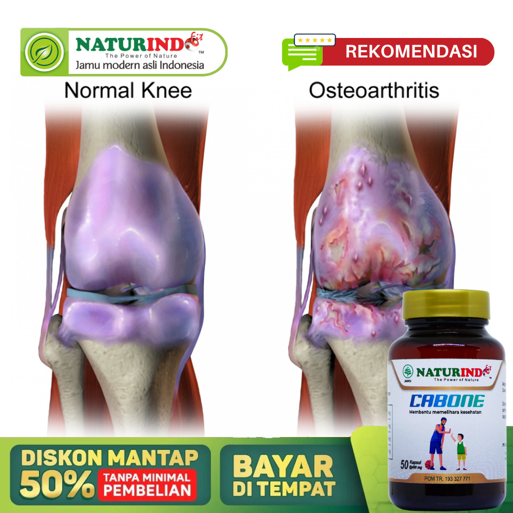 Obat Tulang Keropos, Patah Tulang Pasca Operasi, Tulang Bergeser, Obat Patah Tulang Paling Ampuh, Tu