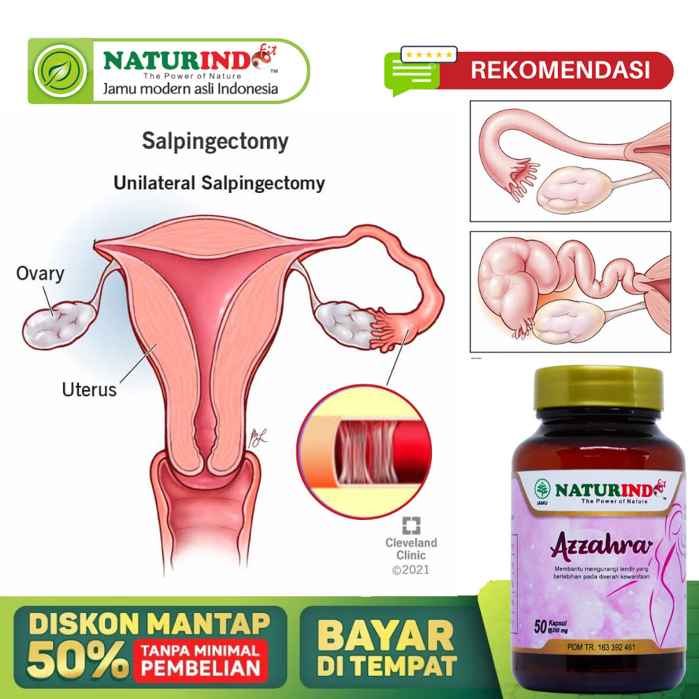 Obat Tuba Falopi Tersumbat Paling Ampuh, Obat Penyumbatan Tuba Palopi Tanpa Operasi, Pembersih Sumba