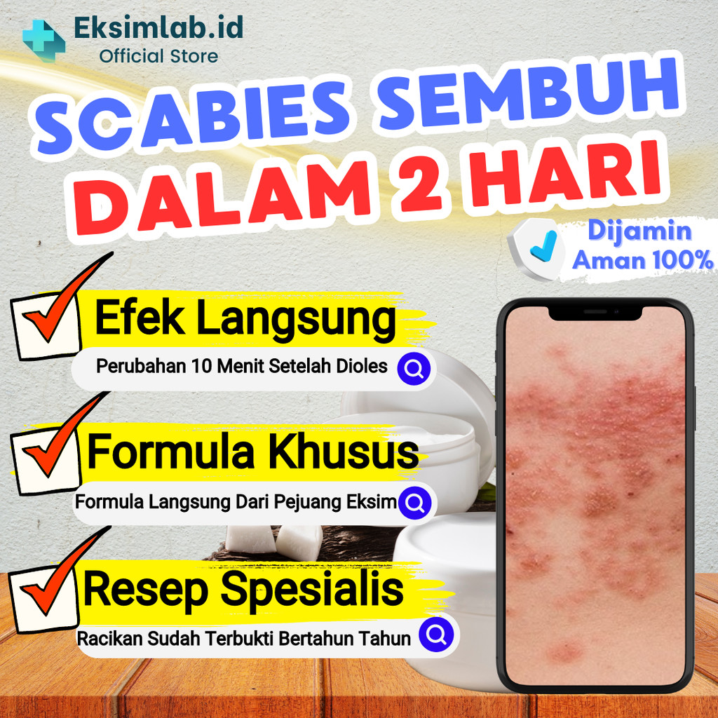 Obat Salep Scabies Kudis Ruam Merah Manusia Anak Dewasa Gatal Tungau Paling Ampuh Racikan Spesialis