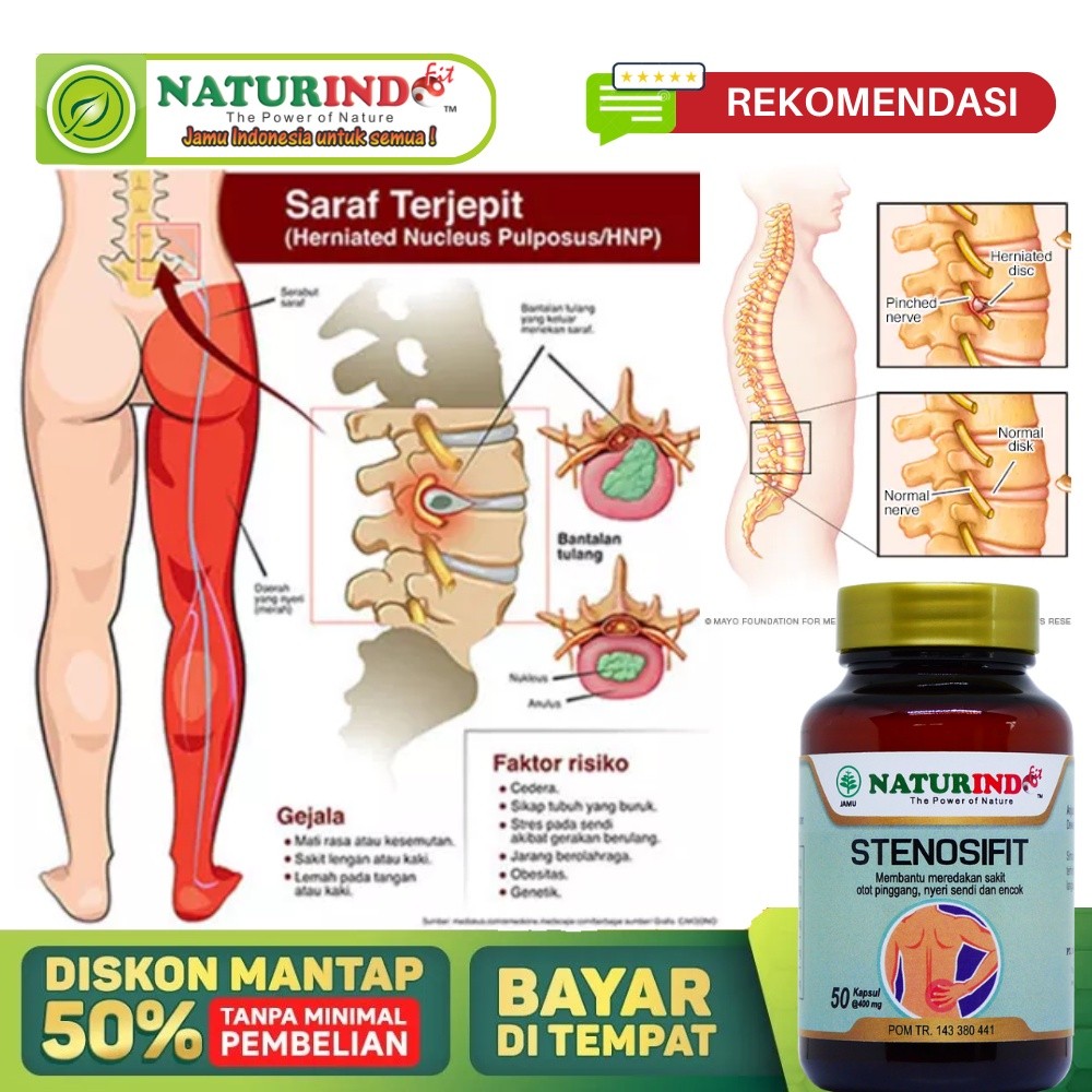 Obat Sakit Syaraf Kejepit Paling Ampuh, Obat Urat Saraf Terjepit, Obat Saraf Kejepit Bokong, Obat Ur