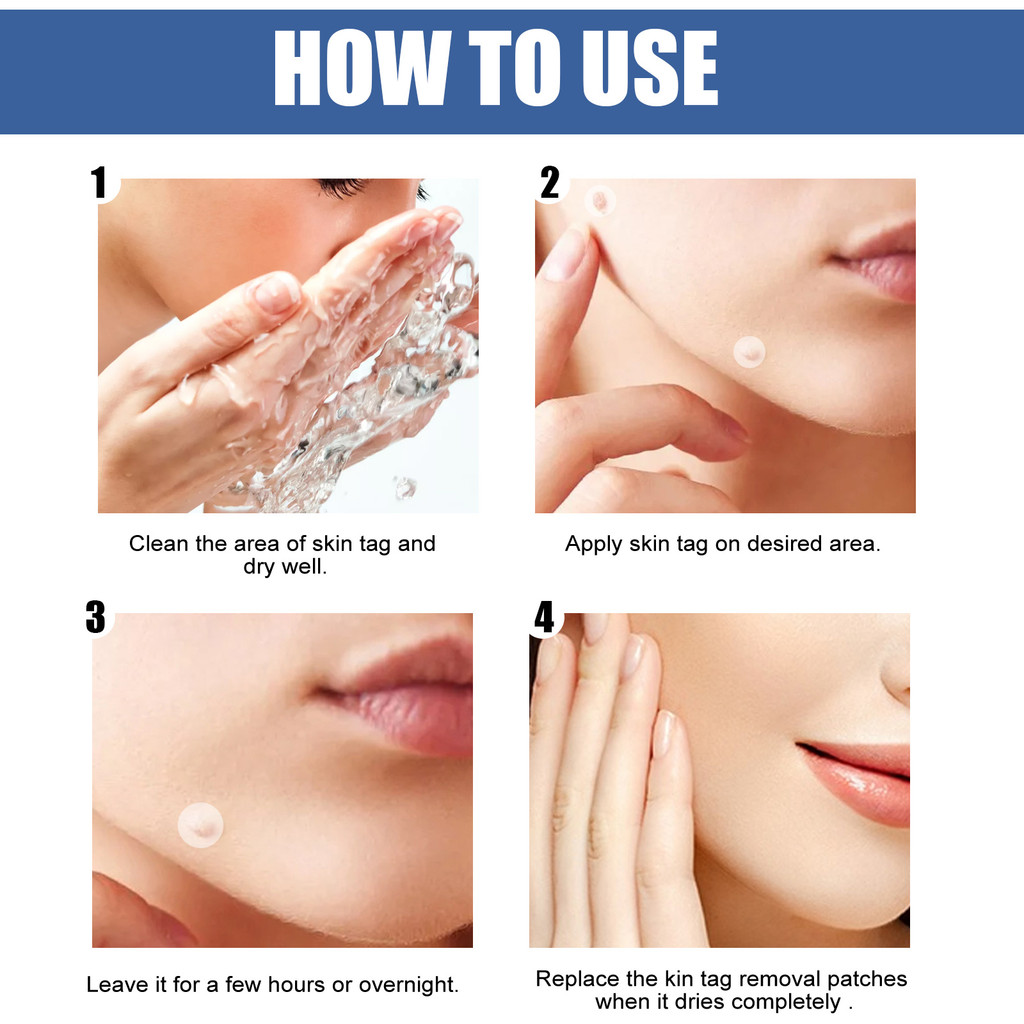 EELHOE Penghilang Kutil Patch Jagung Penghilang Kutil Kulit Perawatan Pembersihan Tahi Lalat Komedo