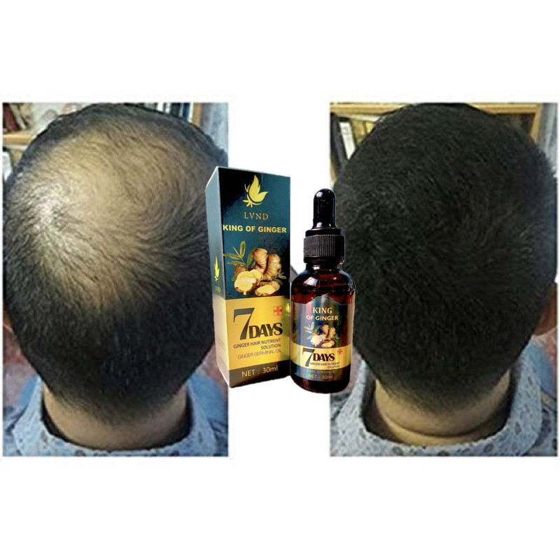 LVND GINGER GERMINAL OIL 30ml Hair Growt Serum