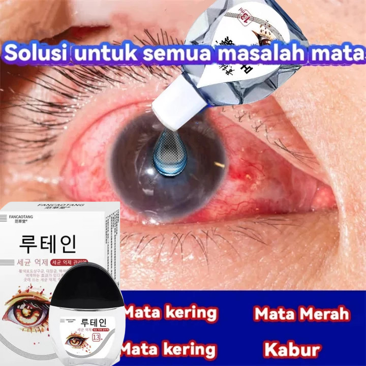 Obat Tetes Mata untuk Katarak | Obat Mata Rabun | Cuci Mata | Tetes Mata untuk Mata Kering | Obat Ma
