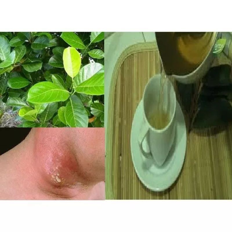 

30 lembar daun nangka obat alami diabetes. HERBAL ALAMI