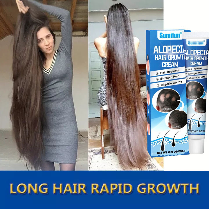 Sunmifun Obat Alopecia Areata, Obat Penumbuh Rambut Botak, Obat Botak Koin, Obat Banyak Pitak, Obat 