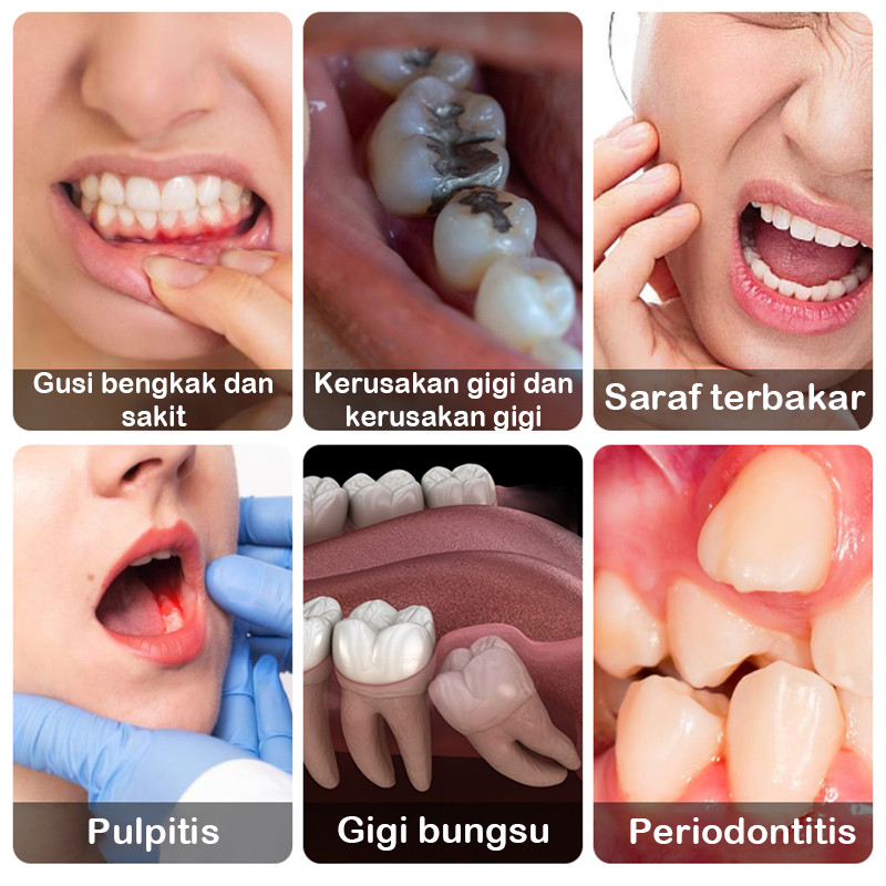 ADY78 Obat sakit gigi semprot semprotan pereda nyeri obat sakit gigi berlubang obat sakit gigi