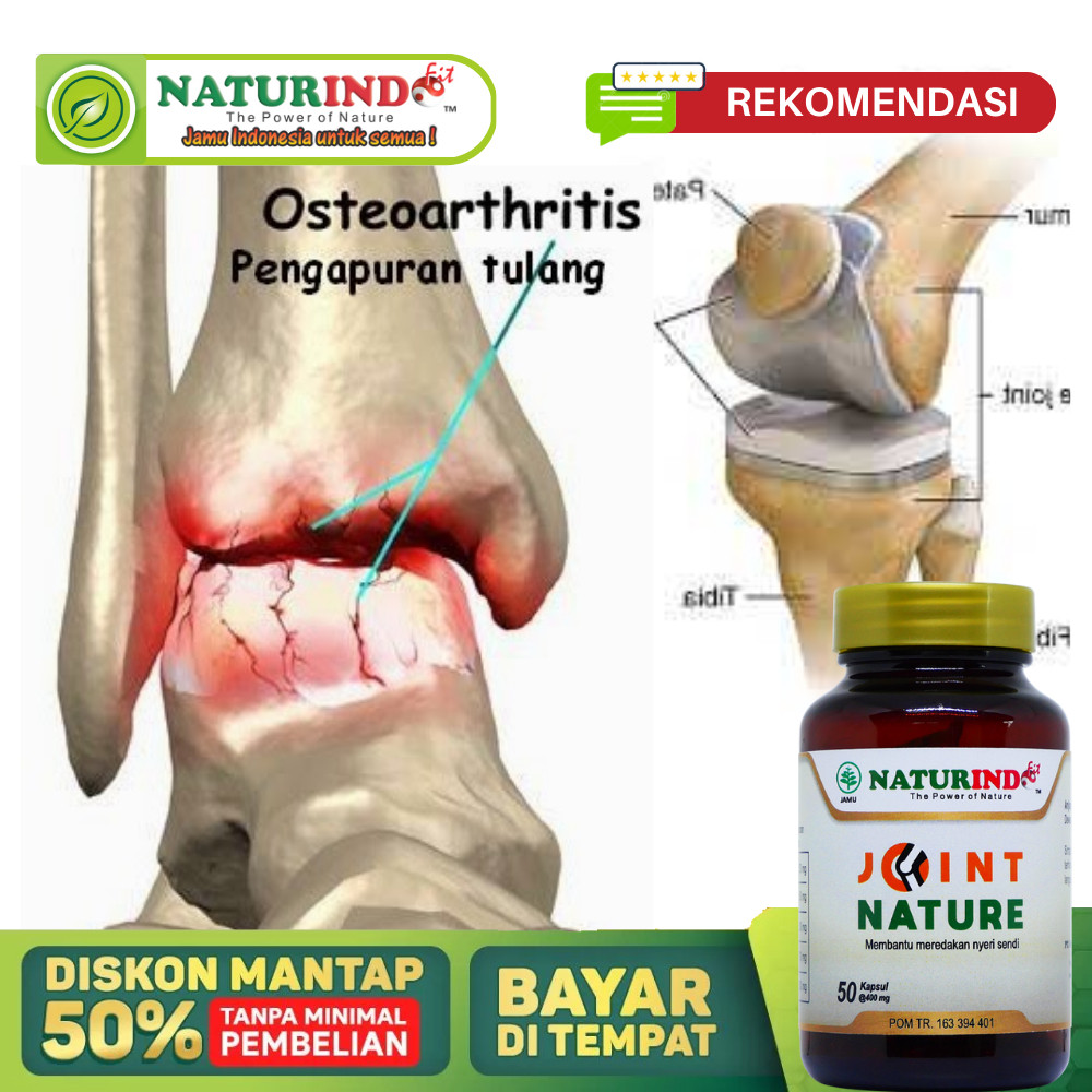 Obat Radang Sendi Paling Ampuh, Nyeri Sendi, Lutut Bengkak Dan Kaku, Asam Urat, Rematik, Pengapuran 