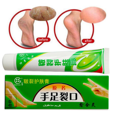 COD Salep Kaki Pecah Pecah Tangan Tumit Kulit Kering Tebal Mengelupas Cream Salep Mulus ( ) (Butami 