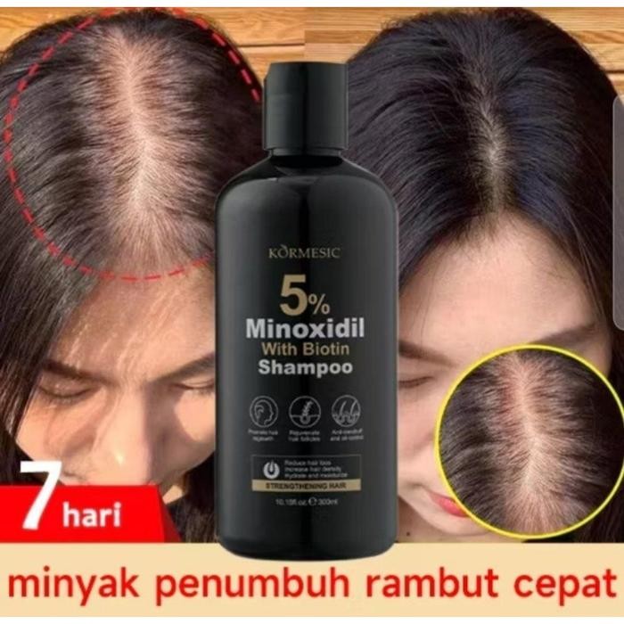 Sampo DHT / DHT Hair Growth Shampo & Serum Penumbuh Rambut Original - SHAMPOO
