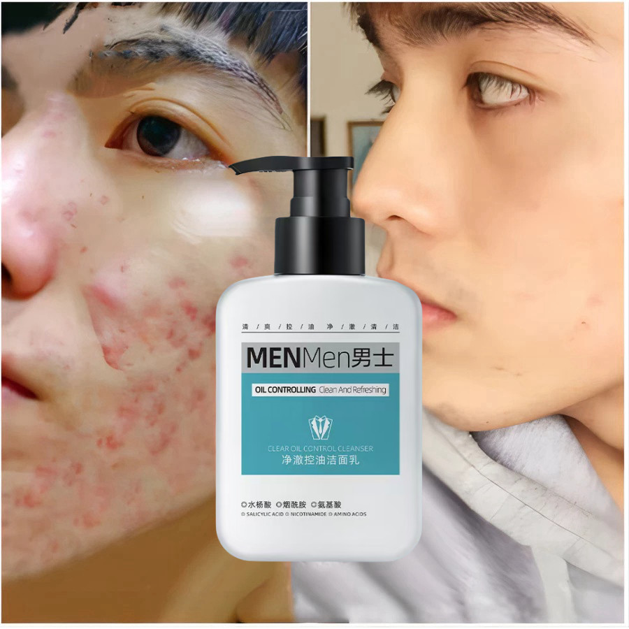 Perawatan wajah pria Pembersih Wajah penghilang jerawat pria Untuk Facial Cleanser 200g sabun cuci m