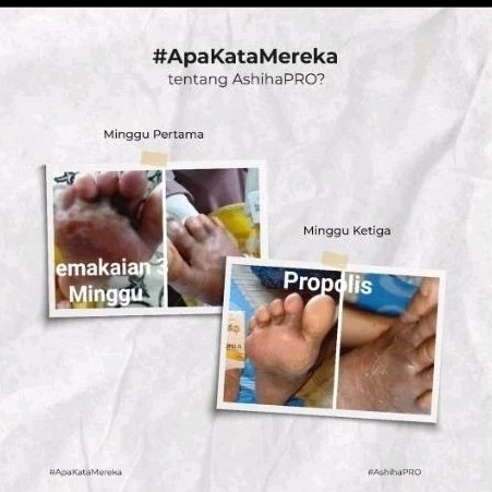 

Propolis madu, propolis habattussauda