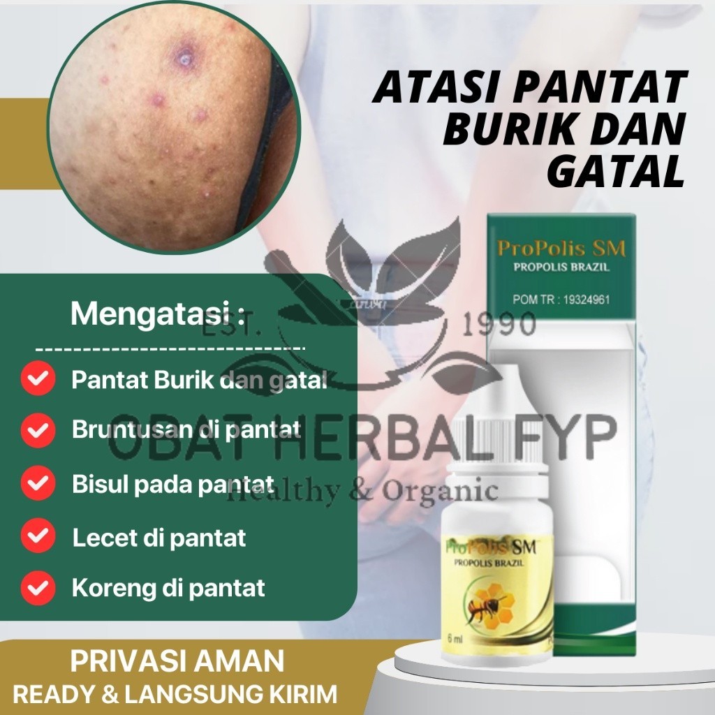 Propolis SM - Penghilang Pantat Gatal dan Hitam, Obat Pantat Burik, Pembersih Koreng Pantat Hitam, O
