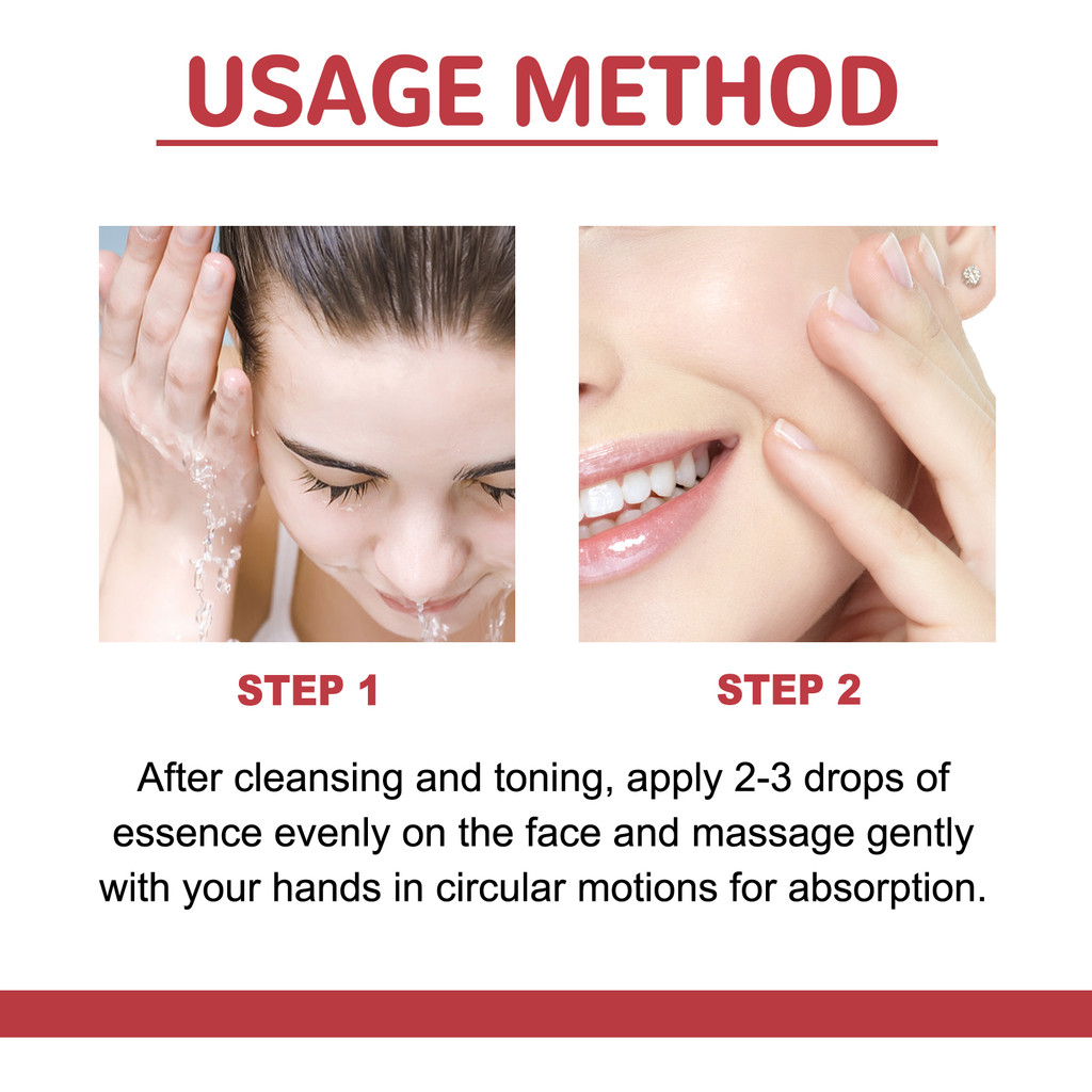 Hoygi Esens Perbaikan Bintik Hitam, Memudarkan Noda Gelap, Menutrisi dan Mencerahkan